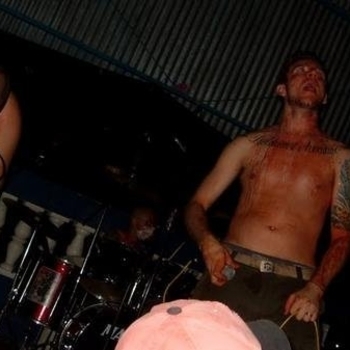 I Shit on Your Face - Brown puke (the tale of an obstructed large intestine)